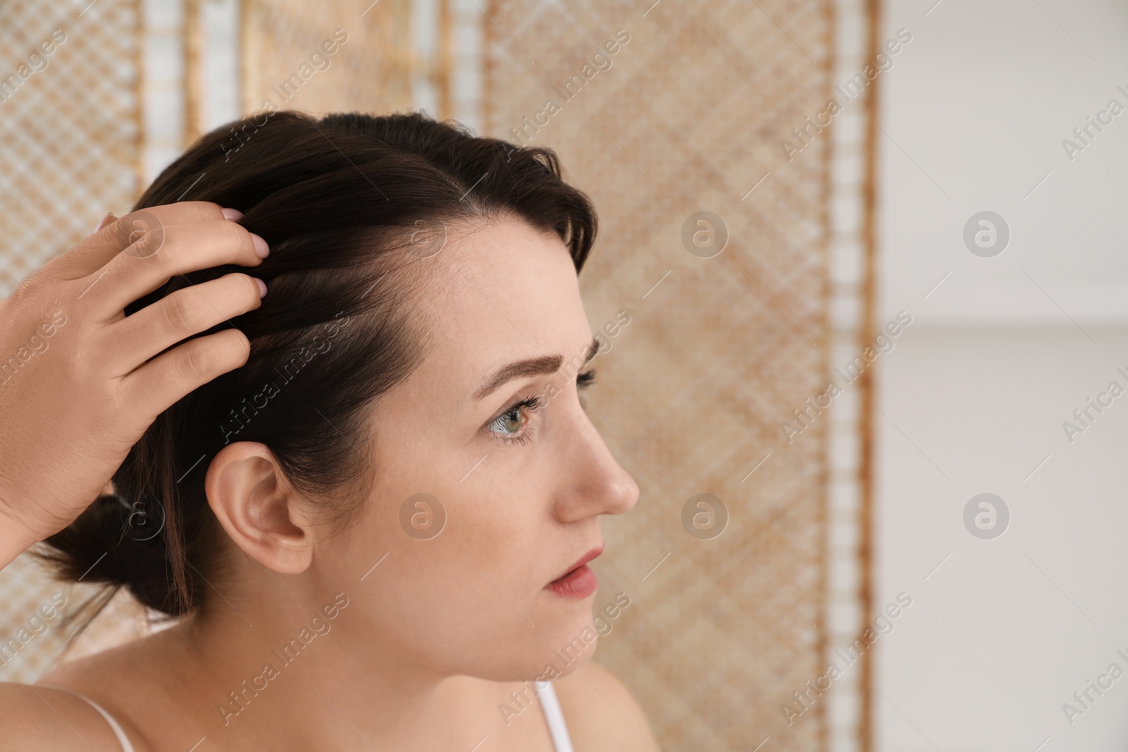 Photo of Woman with hair loss problem at home