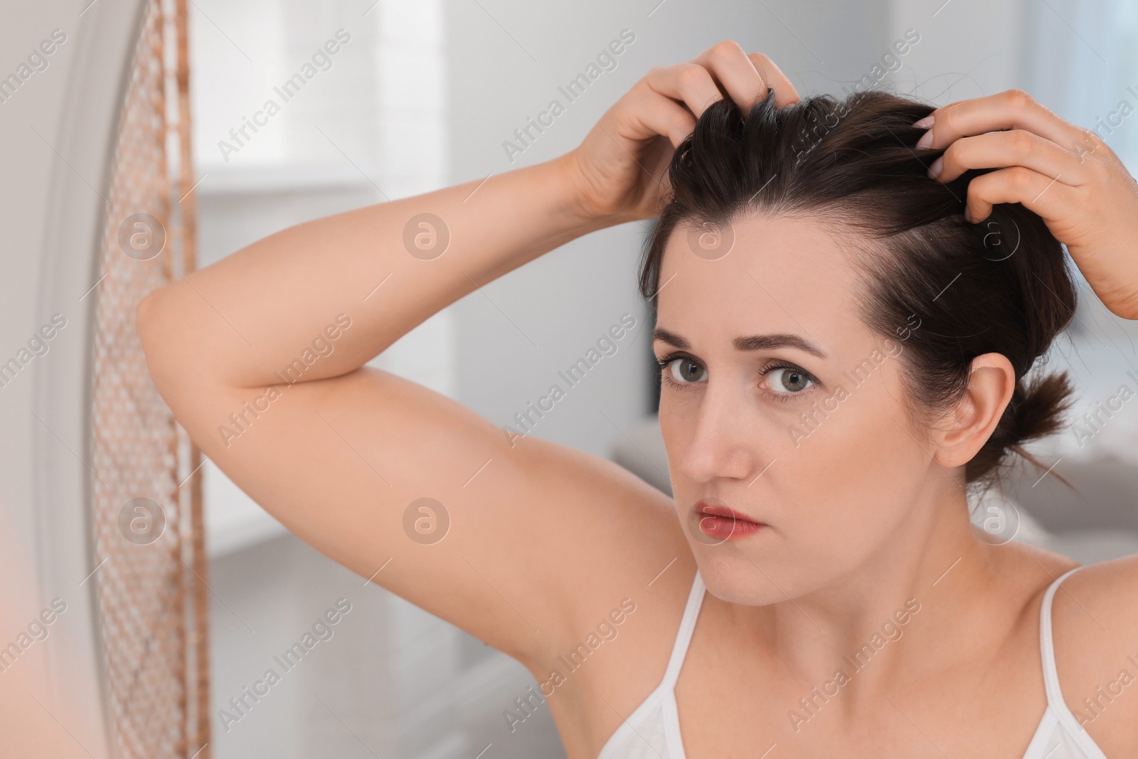 Photo of Woman with hair loss problem at home