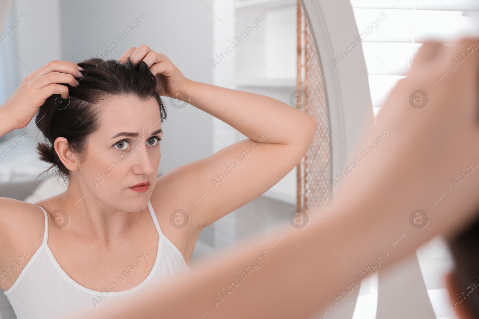 Photo of Woman with hair loss problem at home