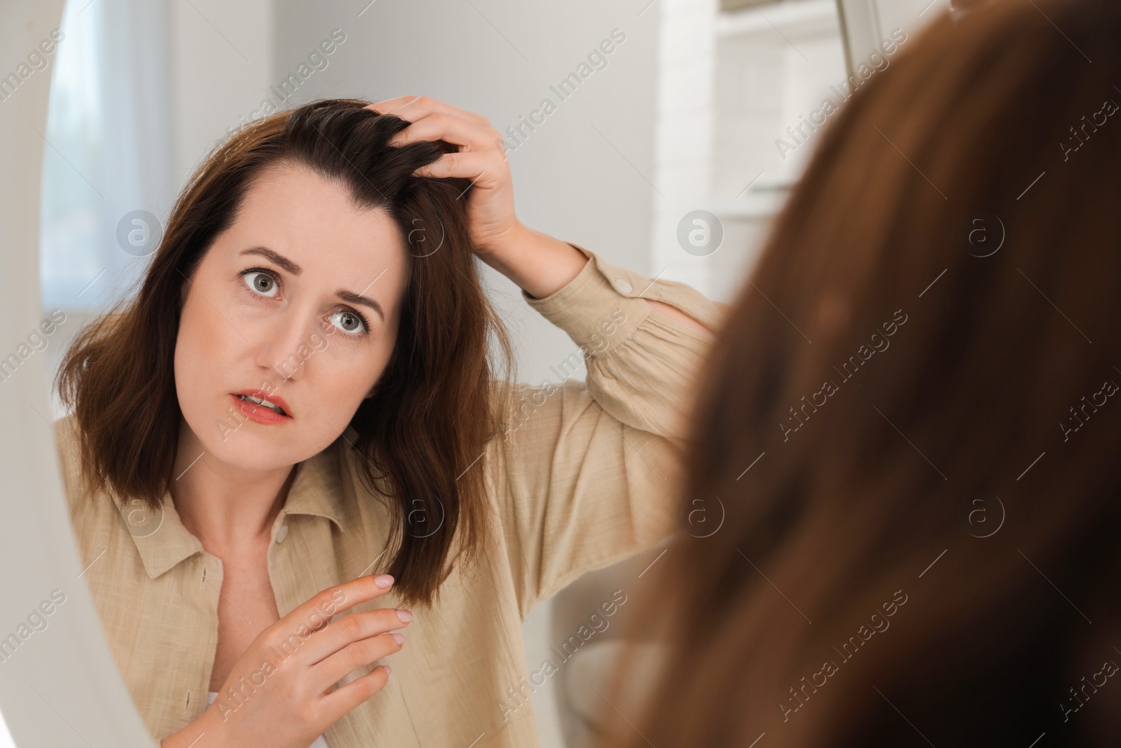 Photo of Woman with hair loss problem at home