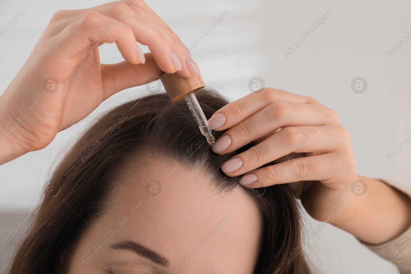 Photo of Hair loss problem. Woman applying serum onto hairline indoors, closeup