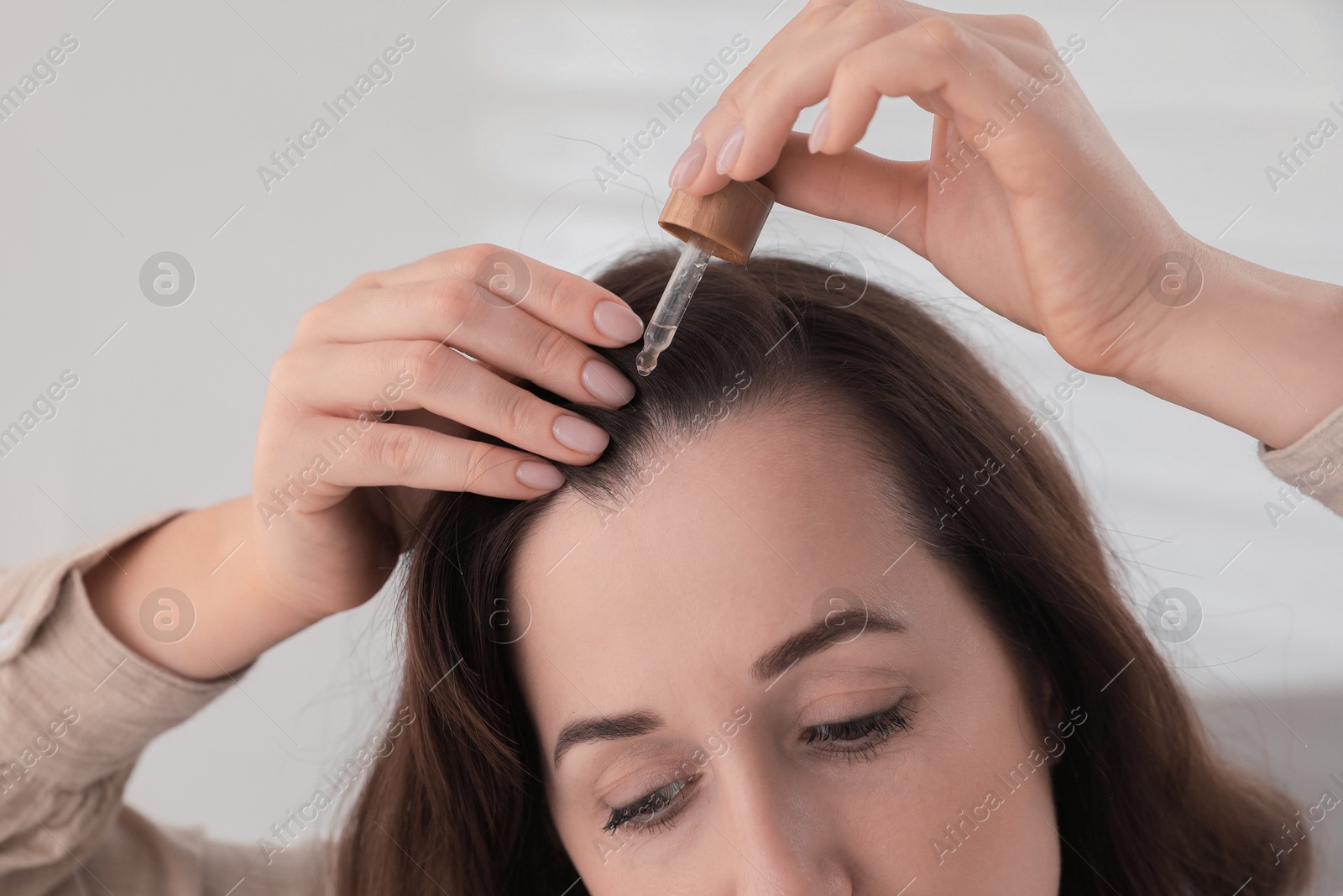 Photo of Hair loss problem. Woman applying serum onto hairline indoors, closeup