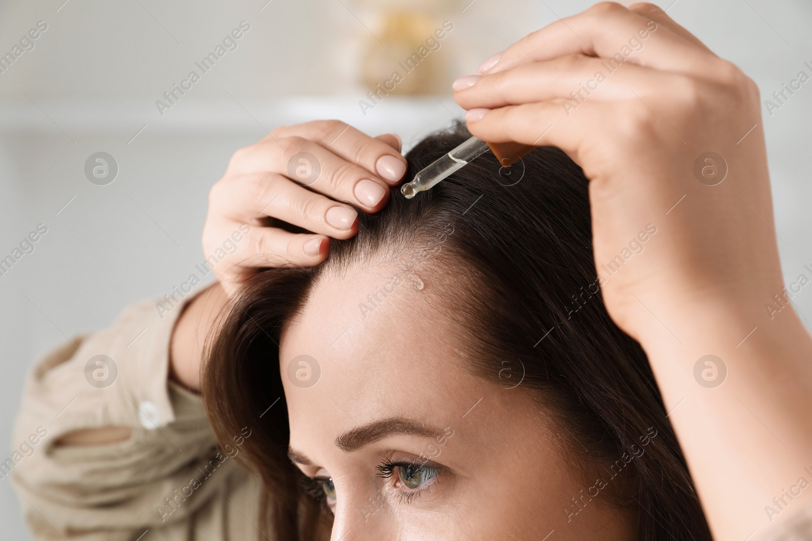 Photo of Hair loss problem. Woman applying serum onto hairline indoors, closeup