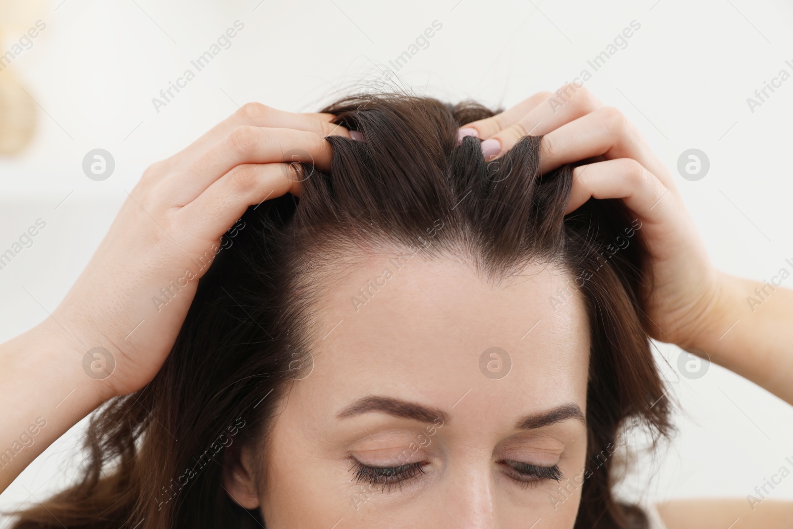 Photo of Woman with hair loss problem at home, closeup