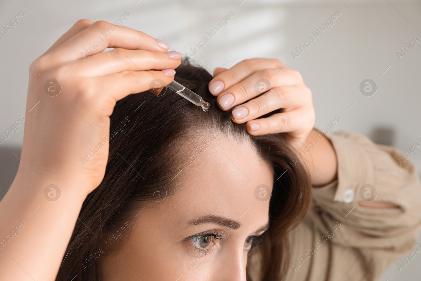 Photo of Hair loss problem. Woman applying serum onto hairline indoors, closeup