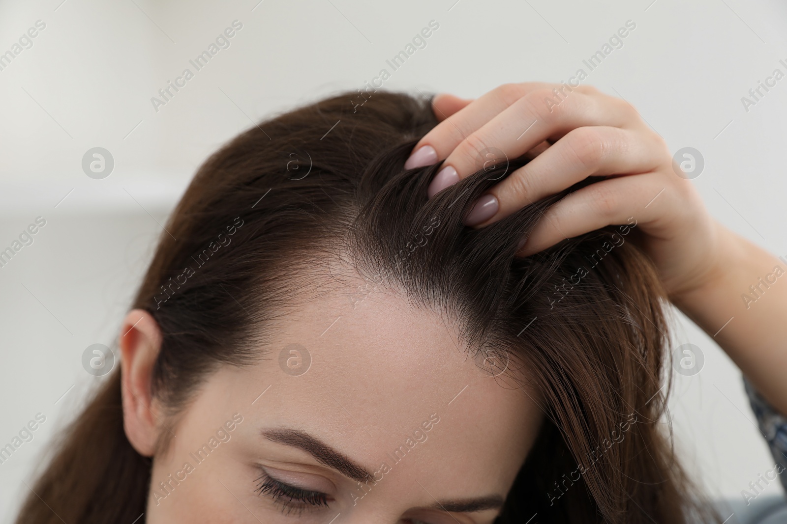 Photo of Woman with hair loss problem at home, closeup