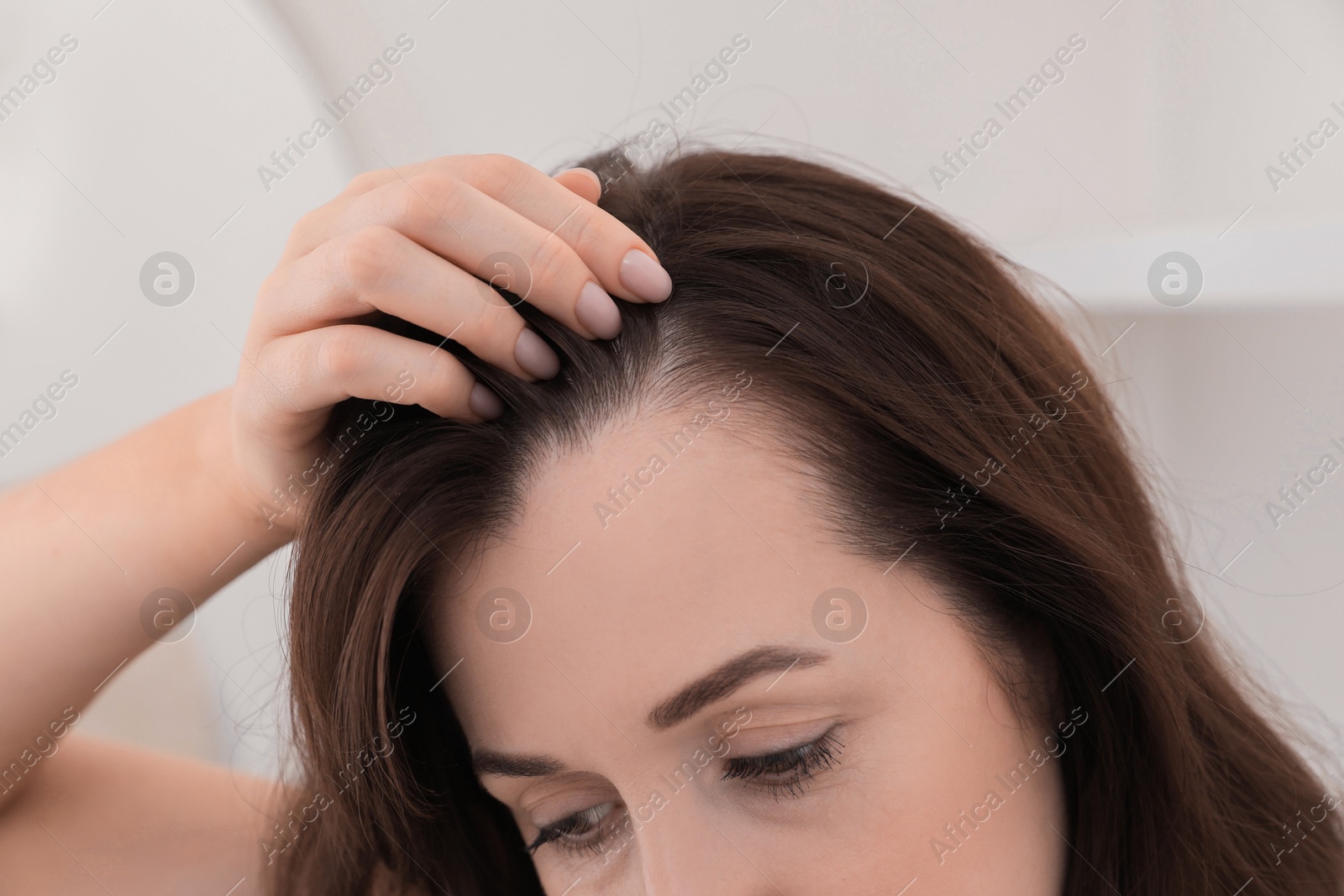 Photo of Woman with hair loss problem at home, closeup