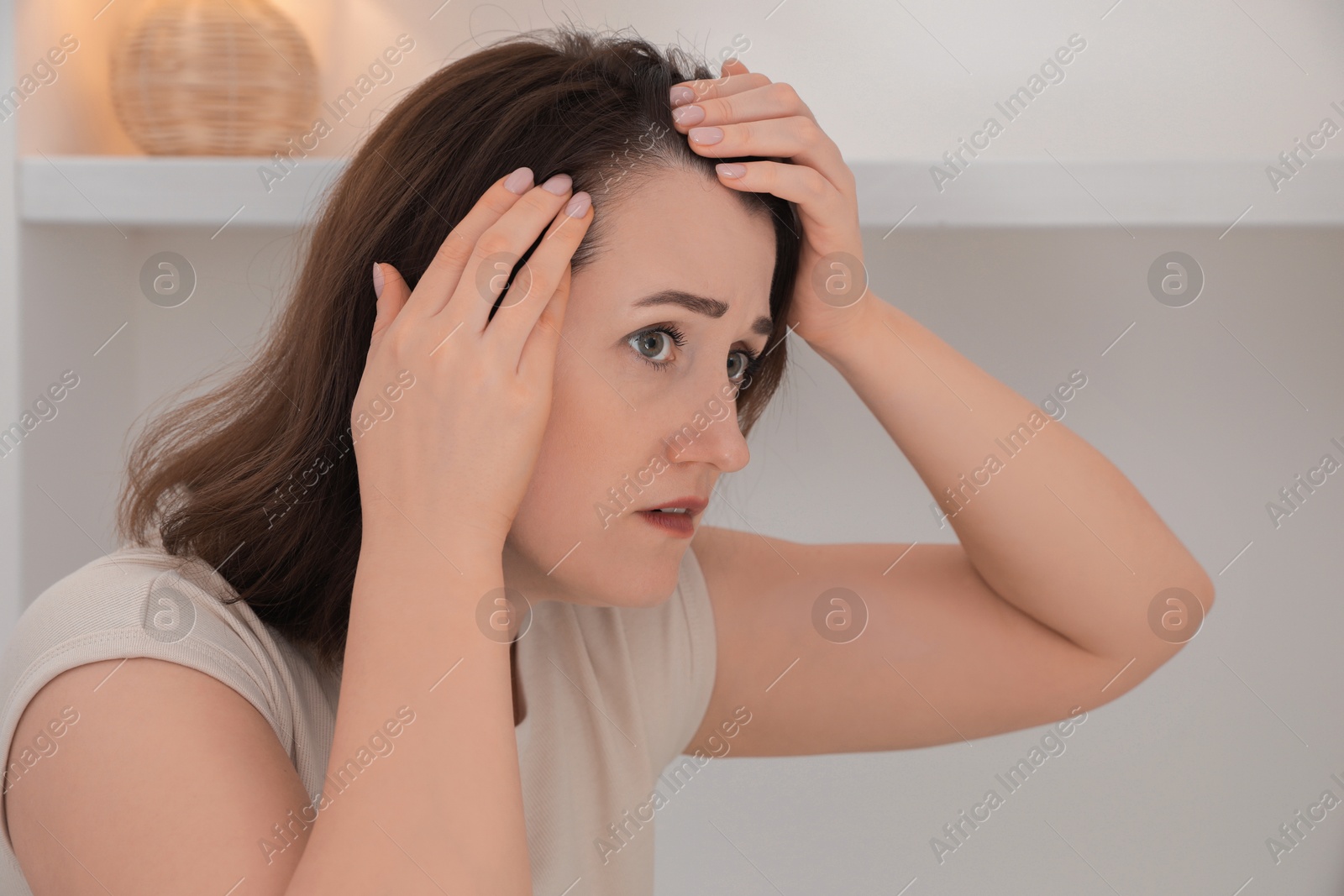 Photo of Woman with hair loss problem at home