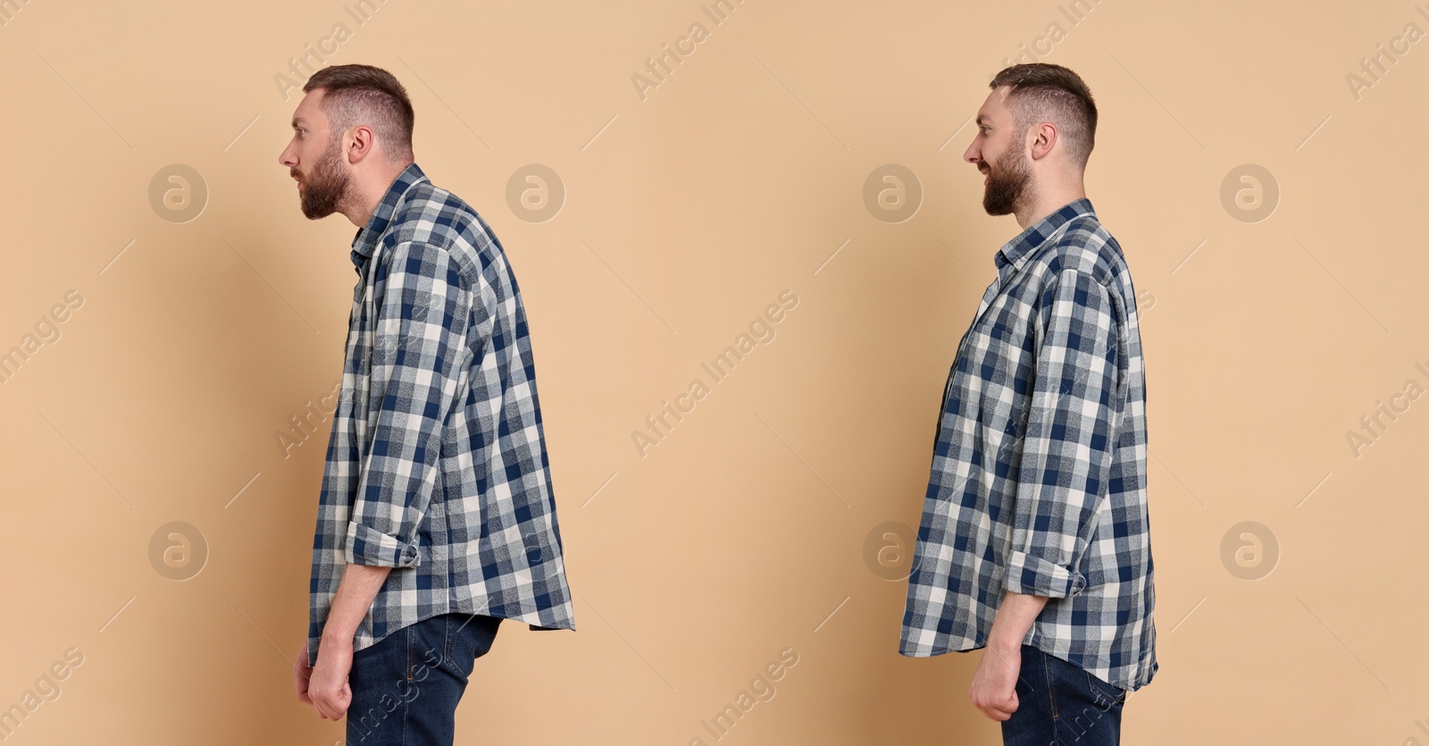 Image of Man with poor and good posture on beige background. Collage of photos