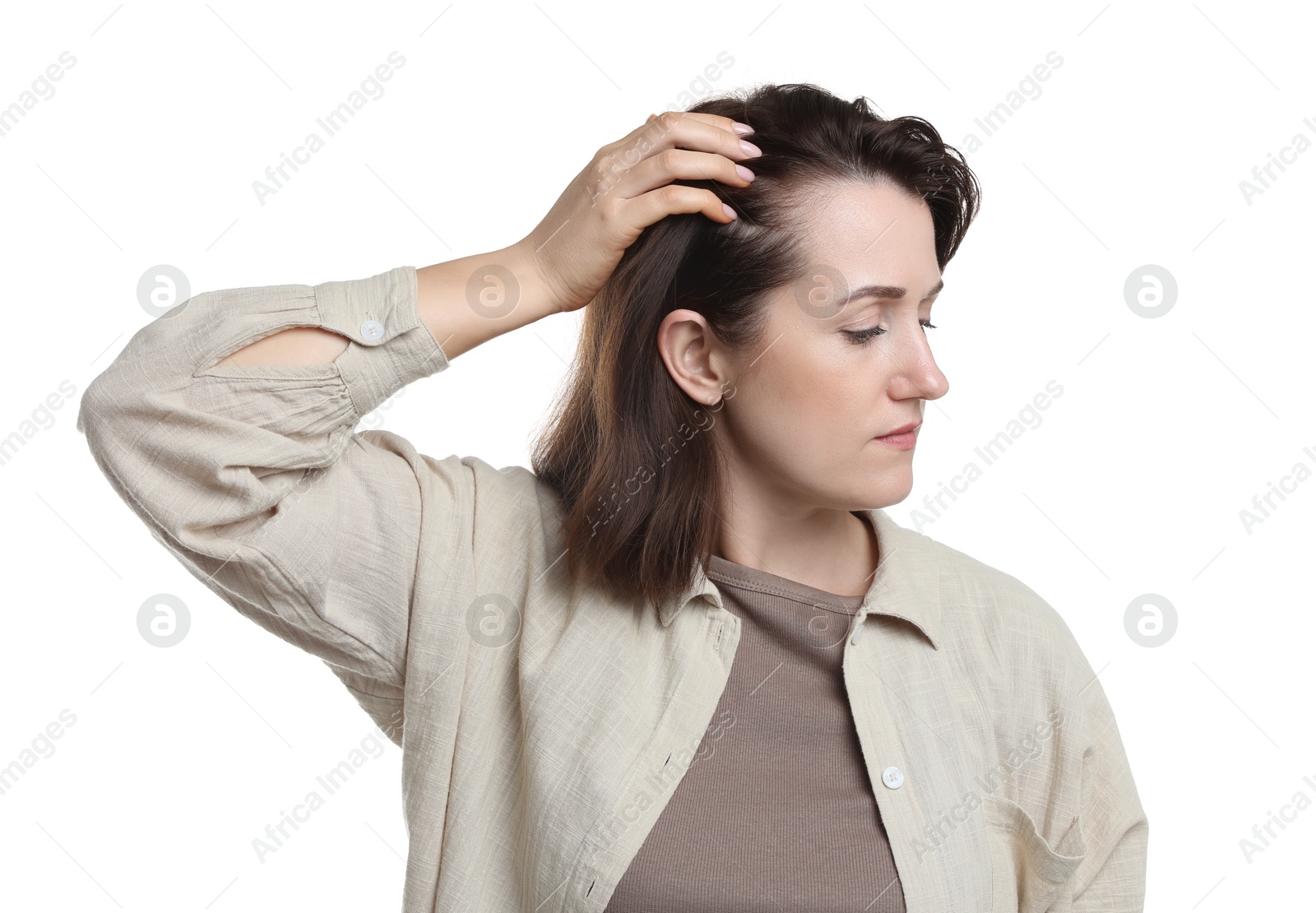 Photo of Woman with hair loss problem on white background