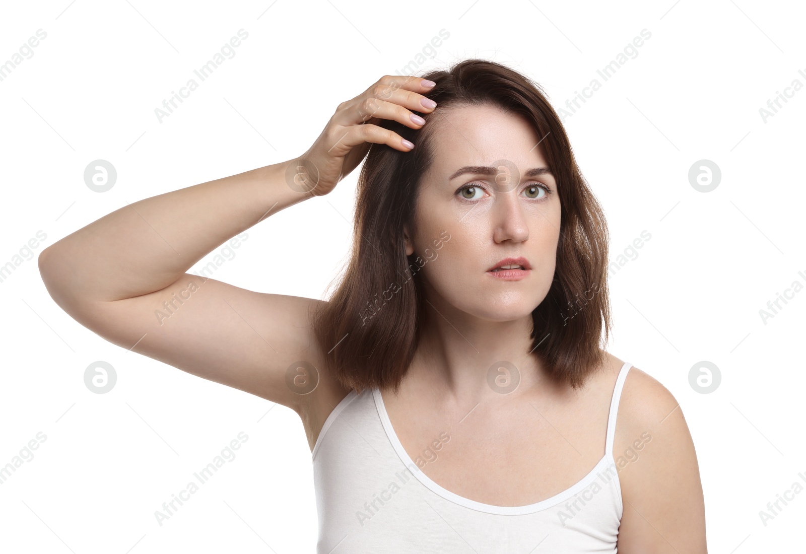 Photo of Woman with hair loss problem on white background