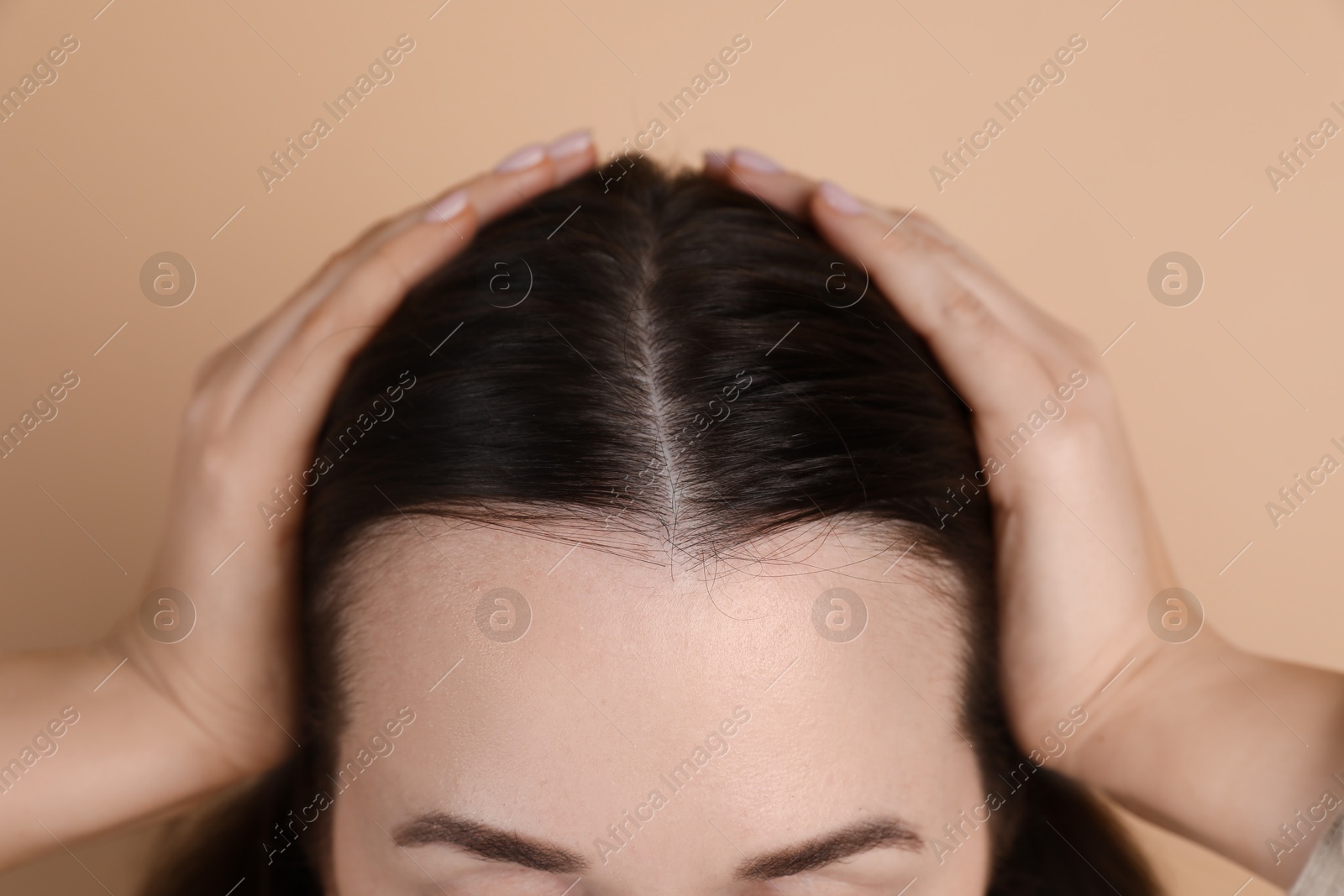 Photo of Woman with hair loss problem on beige background, closeup