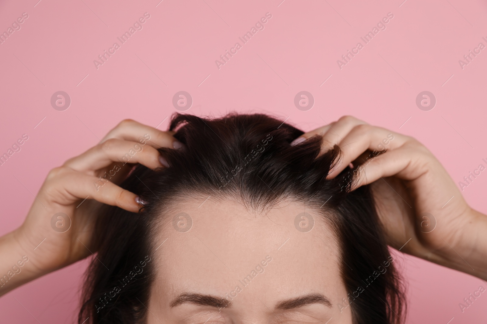 Photo of Woman with hair loss problem on pink background, closeup