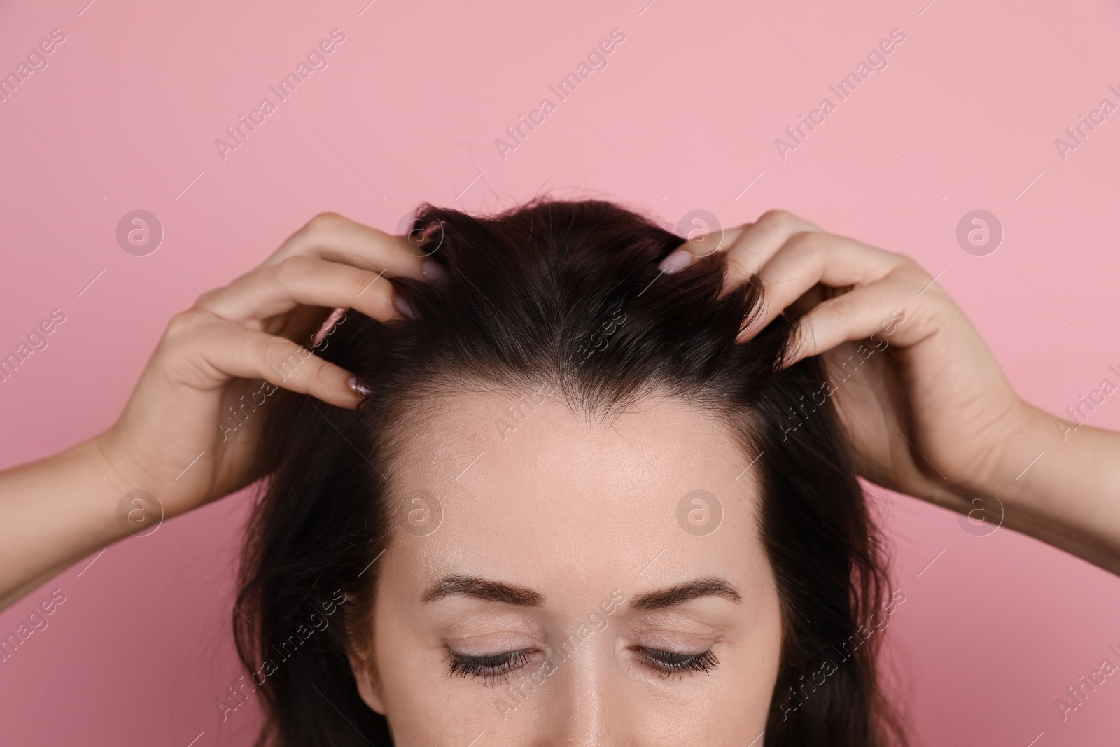 Photo of Woman with hair loss problem on pink background, closeup