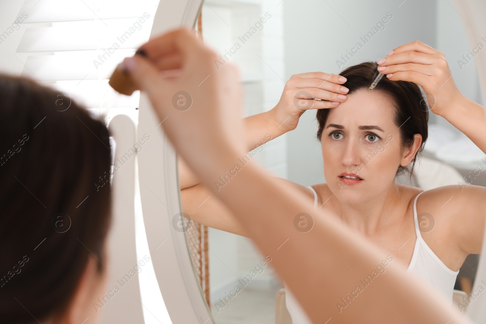 Photo of Hair loss problem. Woman applying serum onto hairline near mirror at home