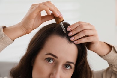 Photo of Hair loss problem. Woman applying serum onto hairline indoors, closeup