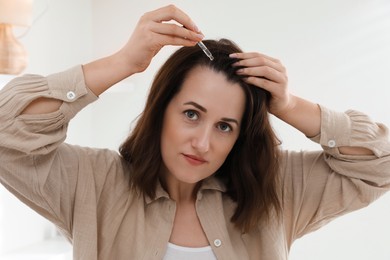 Photo of Hair loss problem. Woman applying serum onto hairline indoors