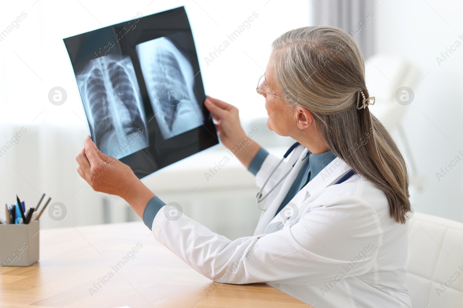 Photo of Lung disease. Doctor examining chest x-ray at table in clinic