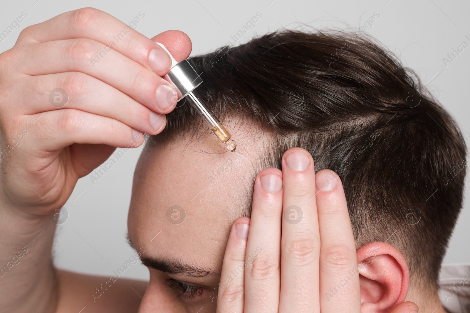 Photo of Baldness concept. Man dripping serum onto his hair on light grey background, closeup