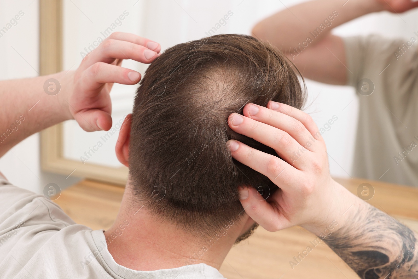 Photo of Baldness concept. Man with bald spot looking at mirror indoors, back view