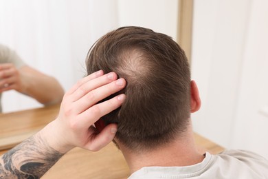 Photo of Baldness concept. Man with bald spot looking at mirror indoors, back view