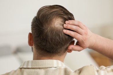 Photo of Baldness concept. Man with bald spot indoors, back view