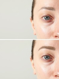 Image of Beautiful woman before and after permanent makeup eyebrow procedure on light background, closeup. Collage of photos