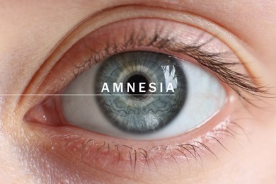 Image of Word Amnesia and woman's eye with illustration of brain, closeup view