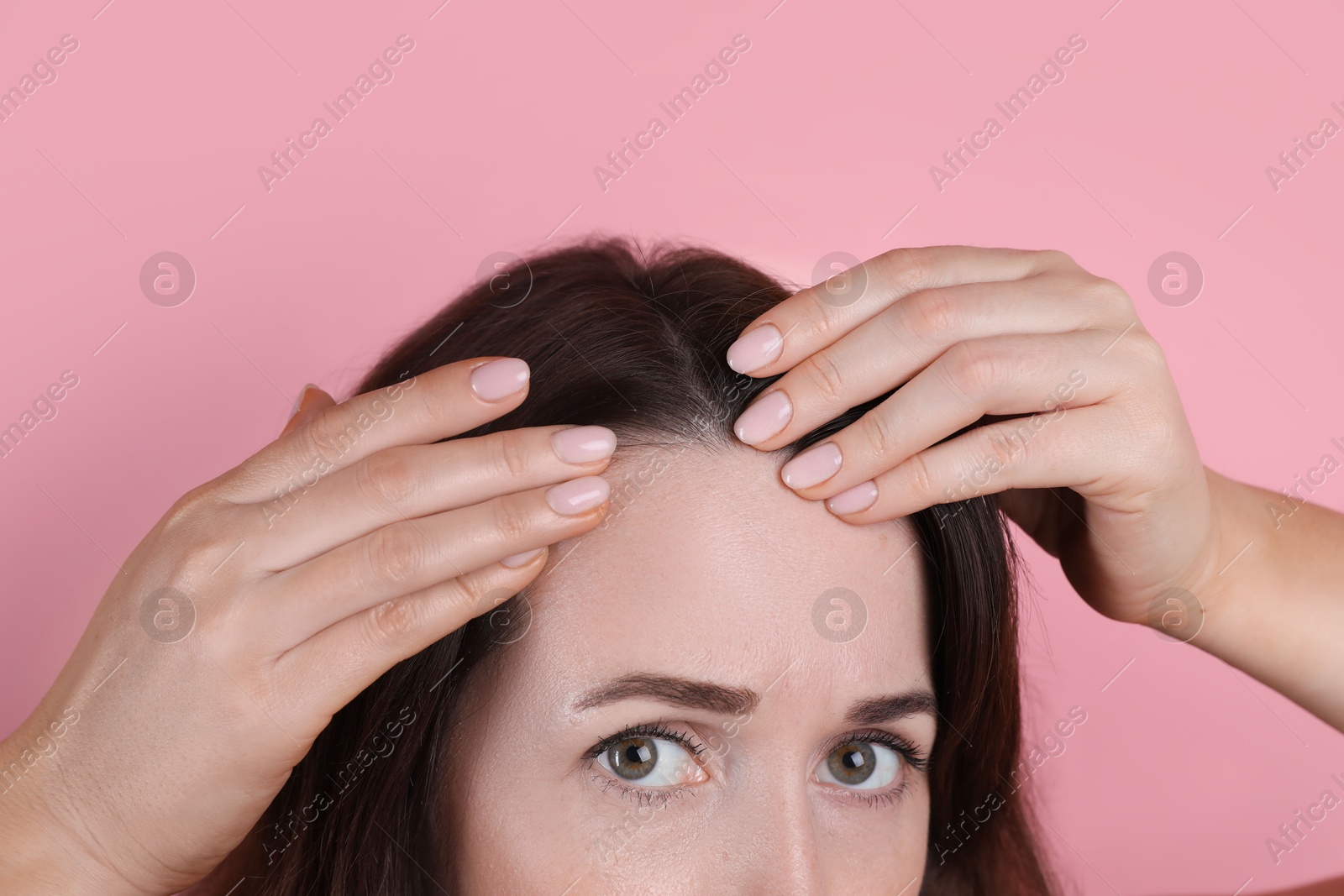 Photo of Woman with hair loss problem on pink background, closeup