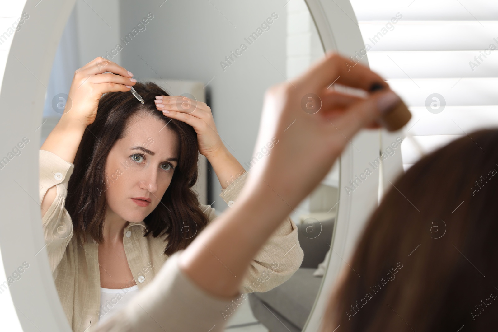 Photo of Hair loss problem. Woman applying serum onto hairline near mirror at home