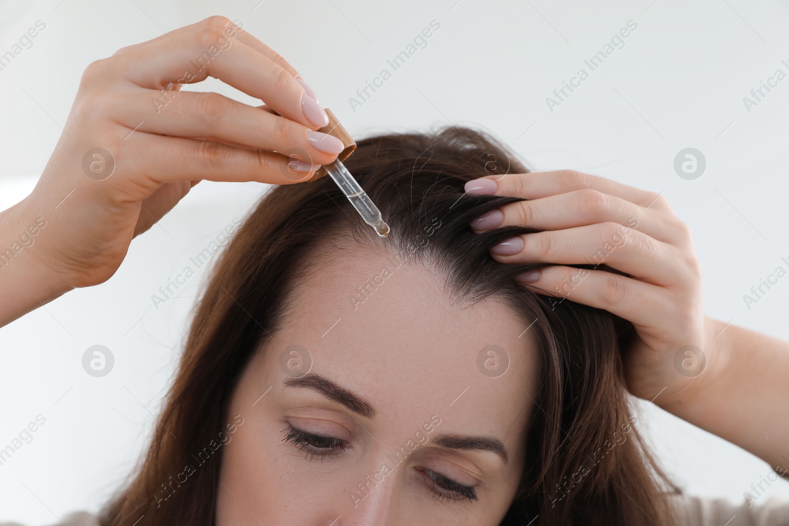 Photo of Hair loss problem. Woman applying serum onto hairline indoors, closeup