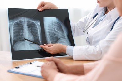 Photo of Lung disease. Doctor showing chest x-ray to her patient at table in clinic, closeup