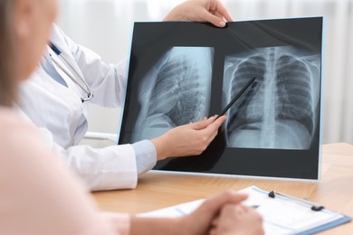 Photo of Lung disease. Doctor showing chest x-ray to her patient at table in clinic, closeup