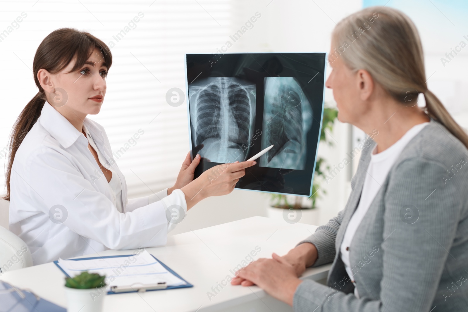 Photo of Lung disease. Doctor showing chest x-ray to her patient at table in clinic