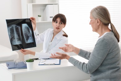 Photo of Lung disease. Doctor showing chest x-ray to her patient at table in clinic