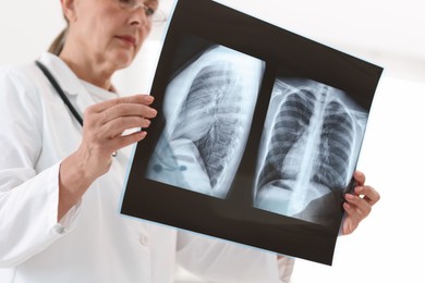 Photo of Lung disease. Doctor examining chest x-ray in clinic, low angle view