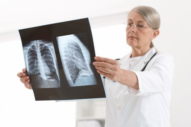 Photo of Lung disease. Doctor examining chest x-ray in clinic