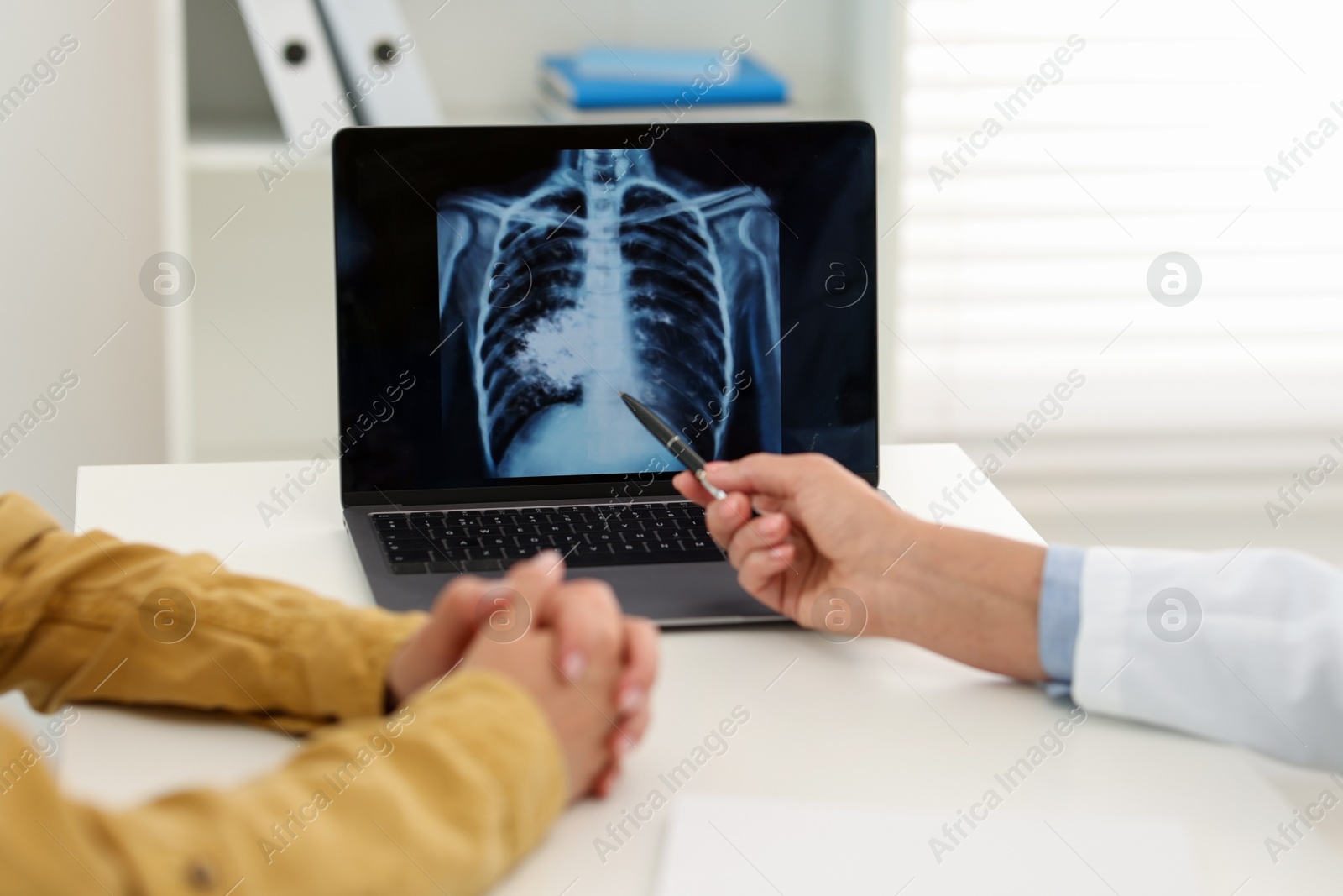 Photo of Lung cancer. Doctor showing chest x-ray on laptop to her patient in clinic, closeup