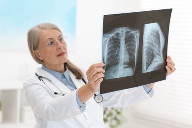 Photo of Lung disease. Doctor examining chest x-ray in clinic