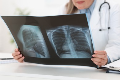 Photo of Lung disease. Doctor examining chest x-ray at table in clinic, closeup