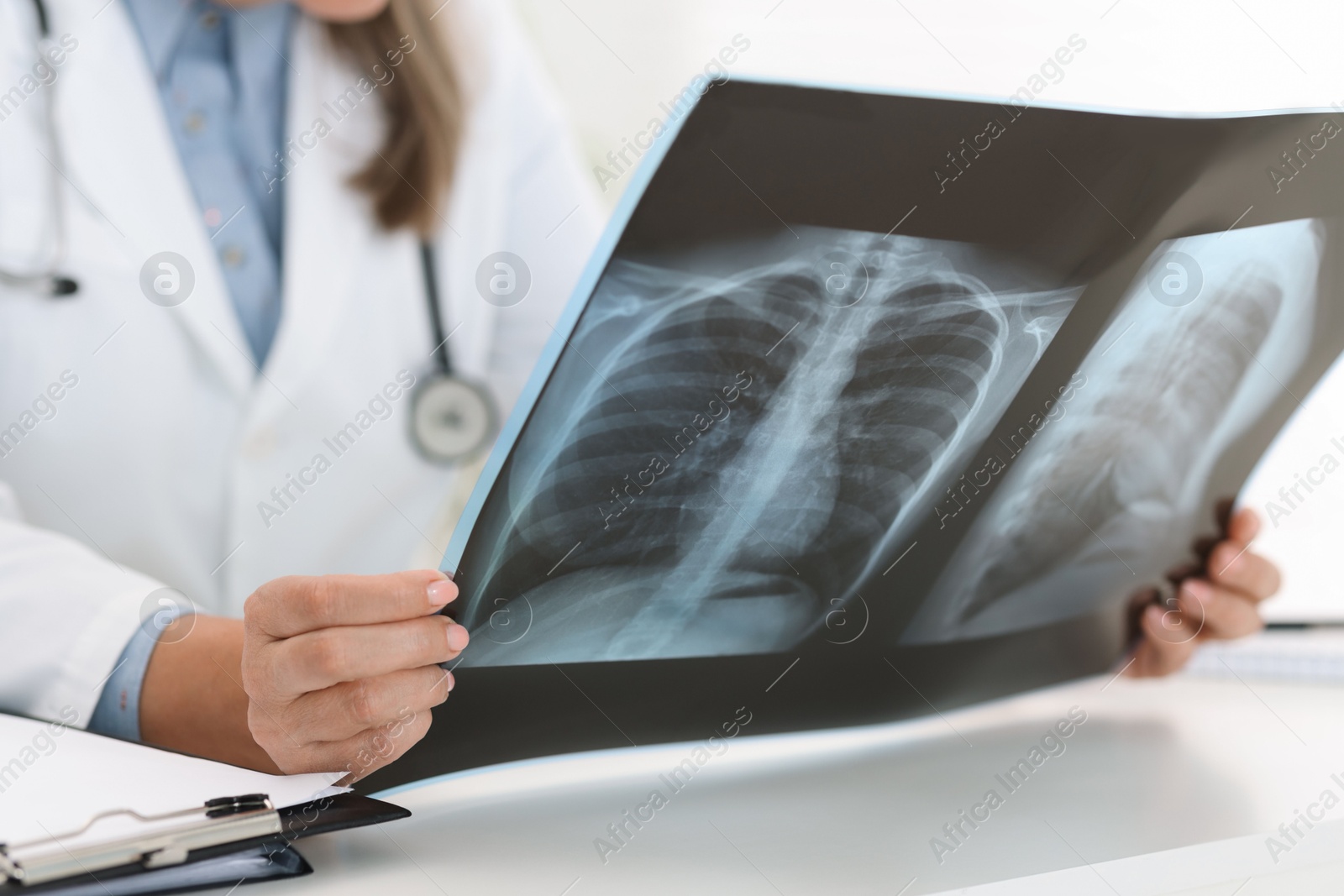 Photo of Lung disease. Doctor examining chest x-ray at table in clinic, closeup