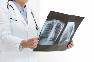 Photo of Lung disease. Doctor examining chest x-ray on light background, closeup