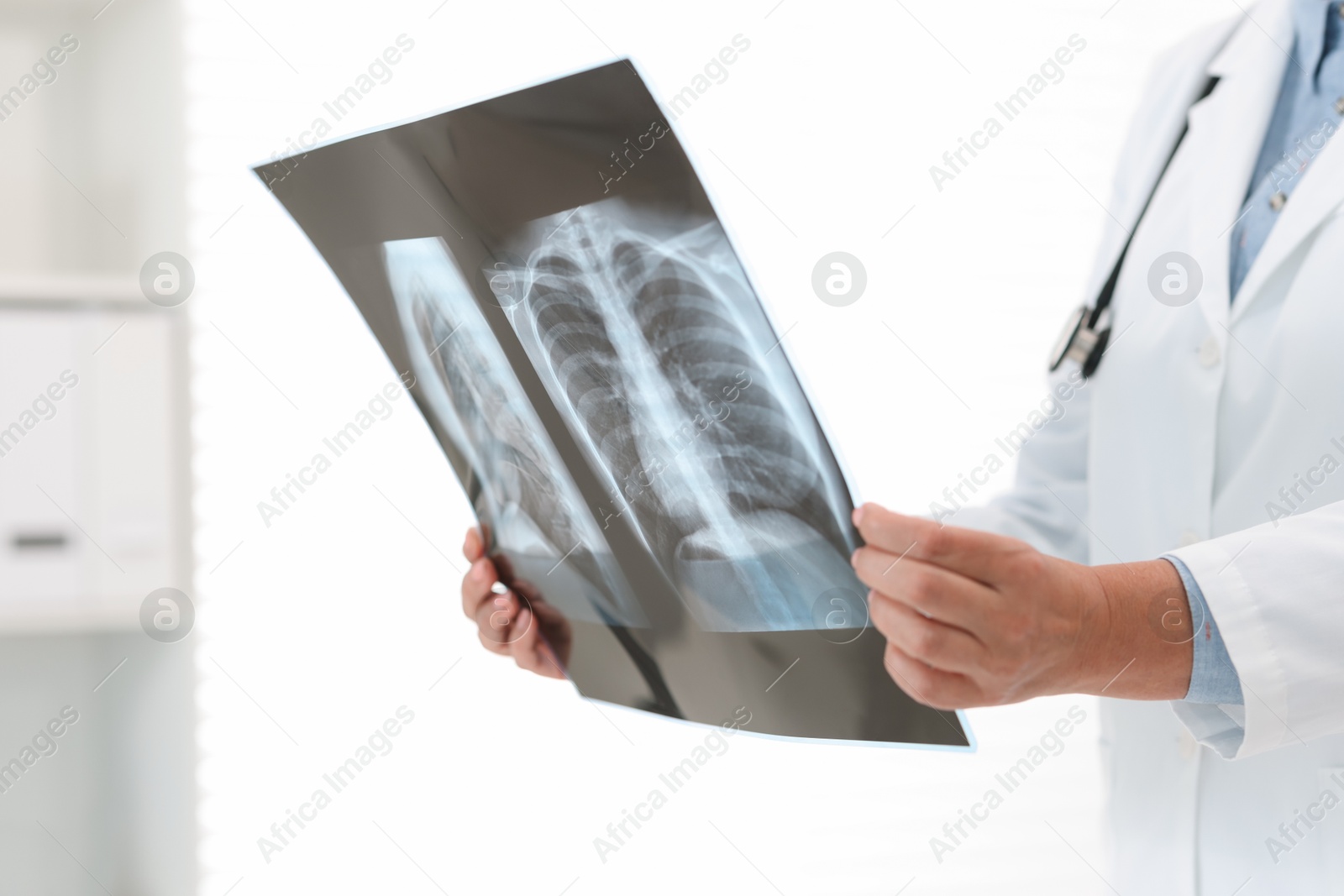 Photo of Lung disease. Doctor examining chest x-ray in clinic, closeup