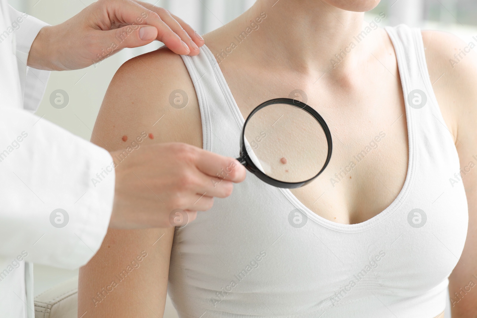 Photo of Doctor examining woman's mole with magnifying glass in clinic, closeup