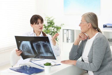 Photo of Lung disease. Doctor with chest x-ray consulting patient in clinic