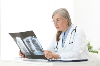 Photo of Lung disease. Doctor examining chest x-ray at table in clinic
