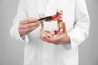 Photo of Doctor showing model of large intestine on grey background, closeup