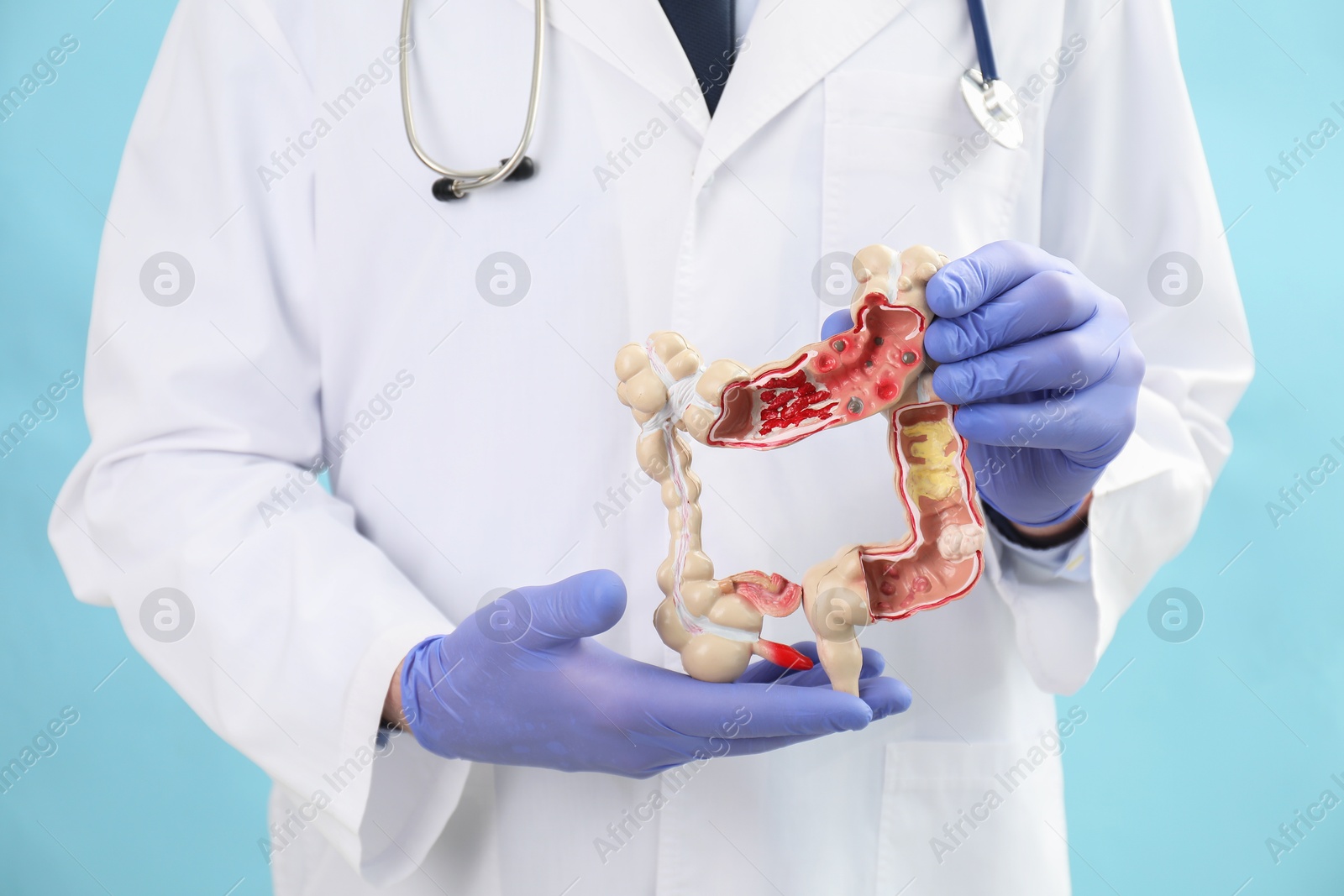 Photo of Doctor with model of large intestine on light blue background, closeup