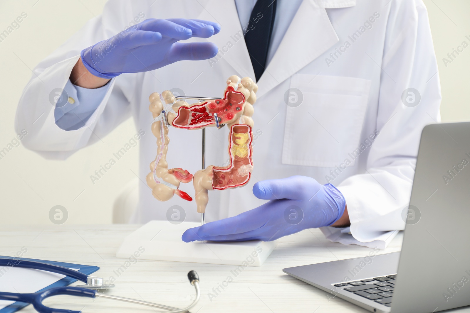 Photo of Doctor showing model of large intestine at white table, closeup