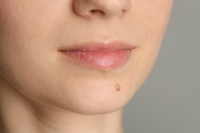 Photo of Woman with mole on her skin against grey background, closeup